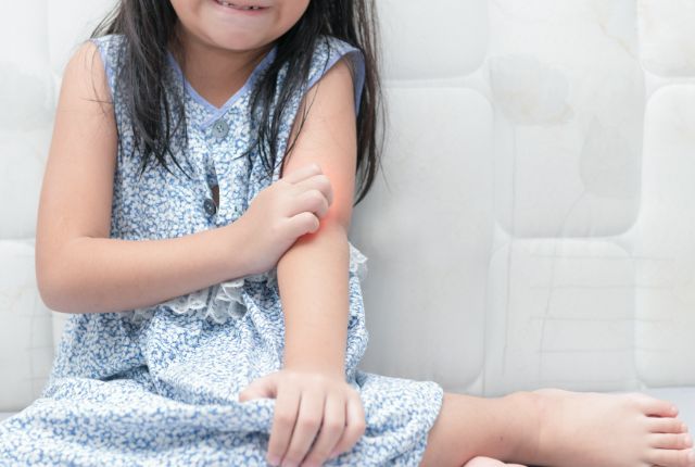 腕に痒みのある女の子